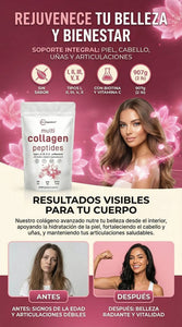 Multi Colágeno Premium Péptidos  -Corre qué se acaba